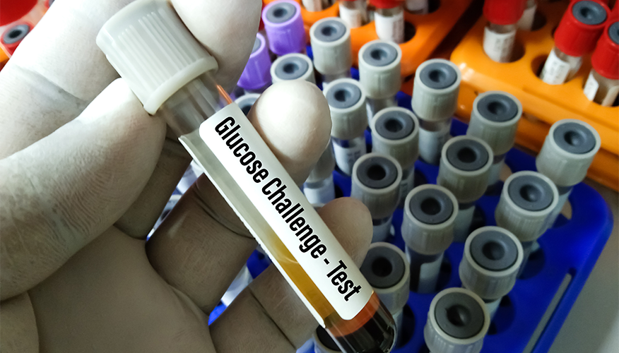 Glucose Challenge Test