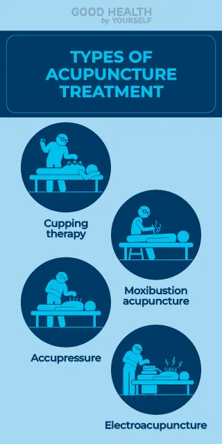 Acupuncture in arthritis pain