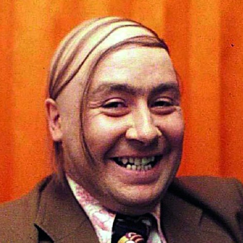 Comb-Over