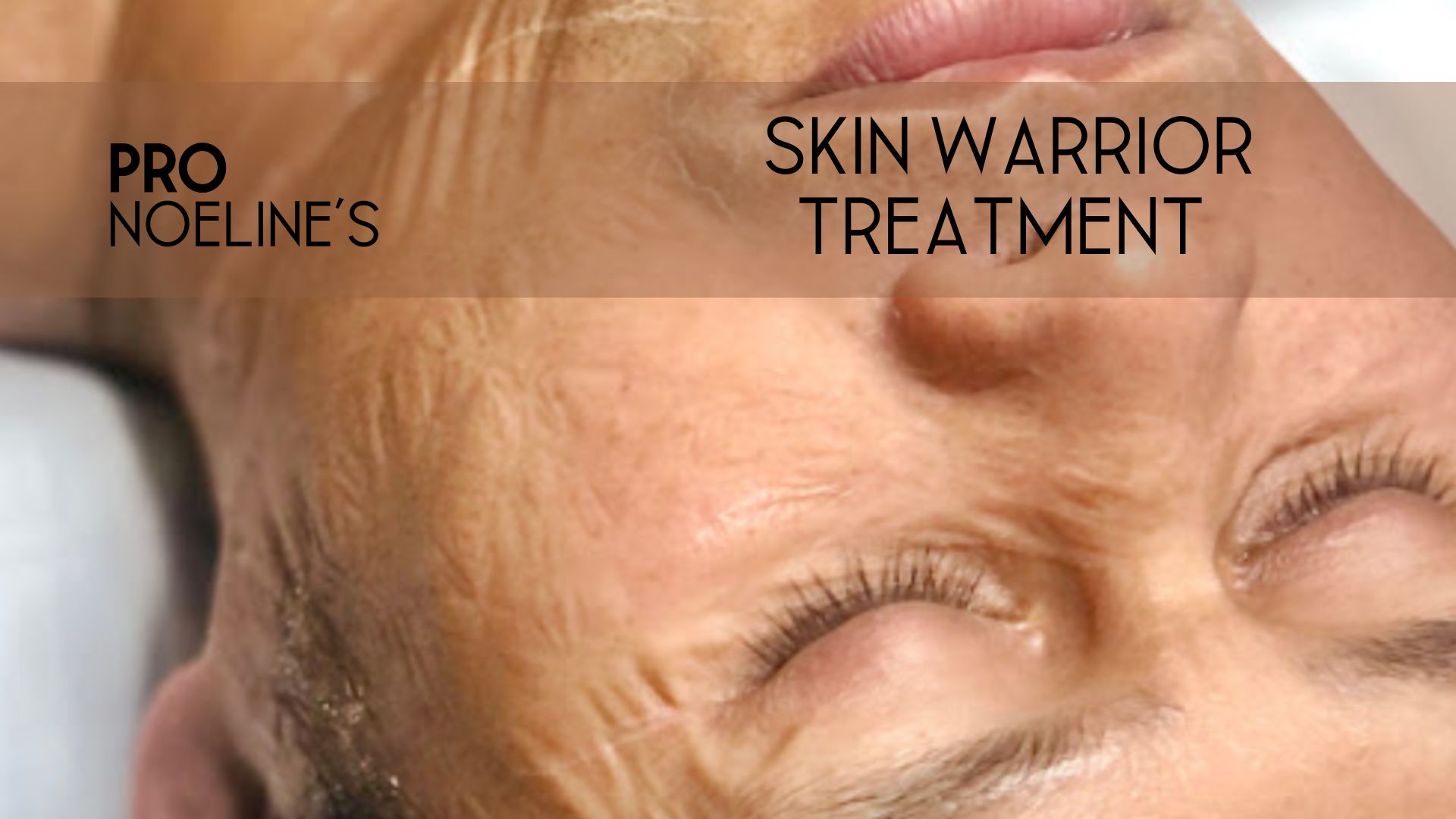 Esthemax skin warrior facial