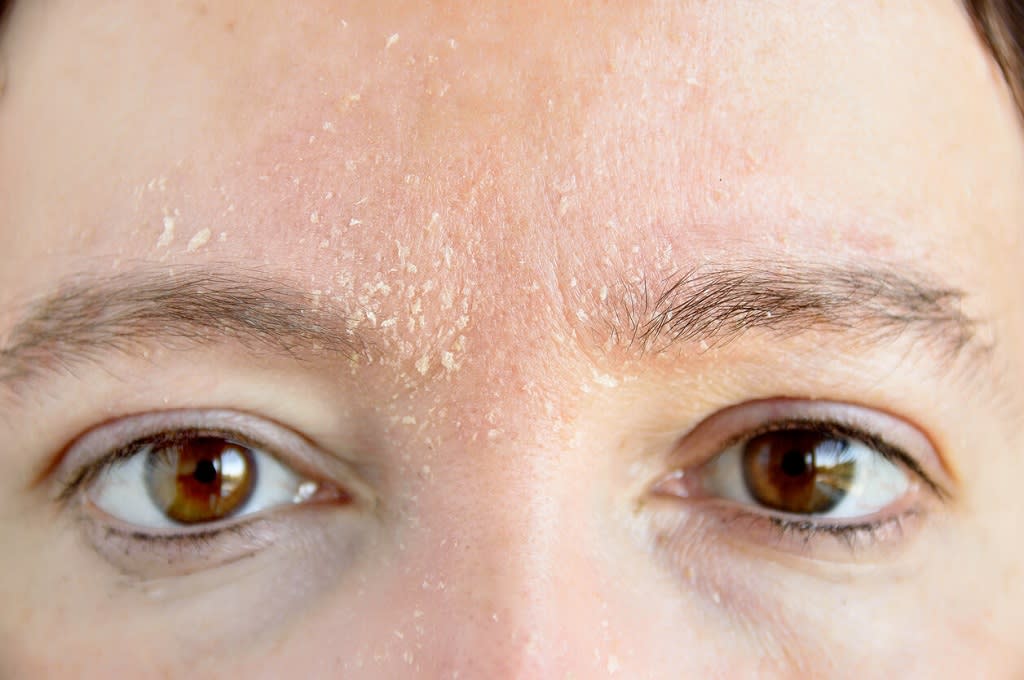 5 Produk Skincare Terbaik untuk Kulit Kering.jpg