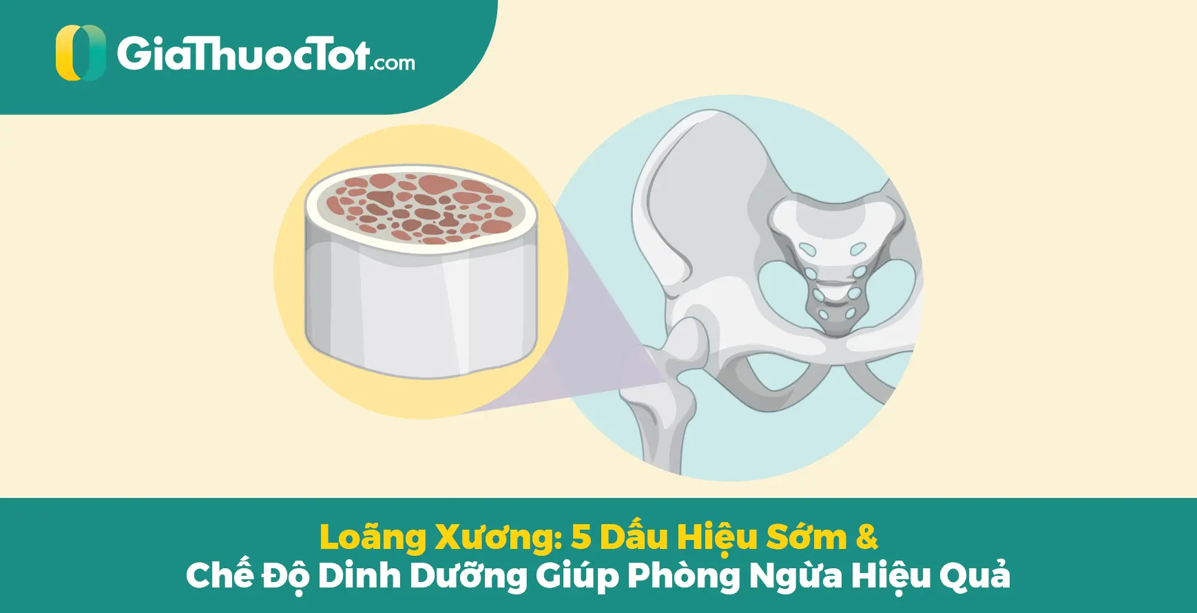 Loãng Xương: 5 Dấu Hiệu Sớm & Chế Độ Dinh Dưỡng Giúp Phòng Ngừa Hiệu Quả