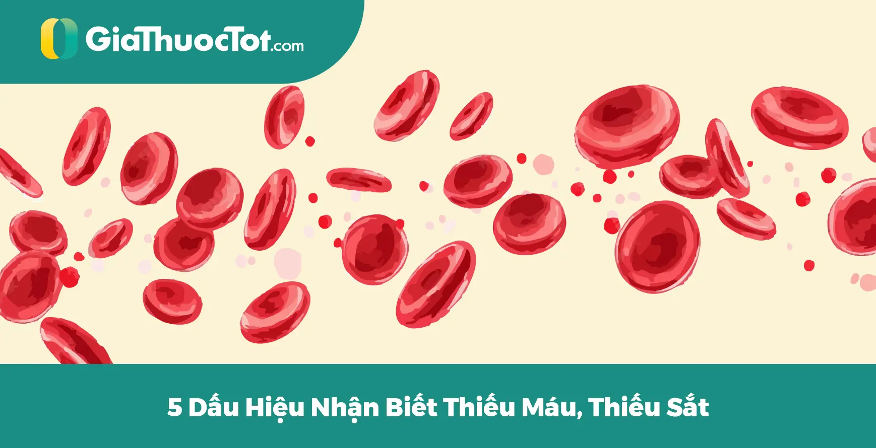 5 Dấu Hiệu Nhận Biết Thiếu Máu, Thiếu Sắt