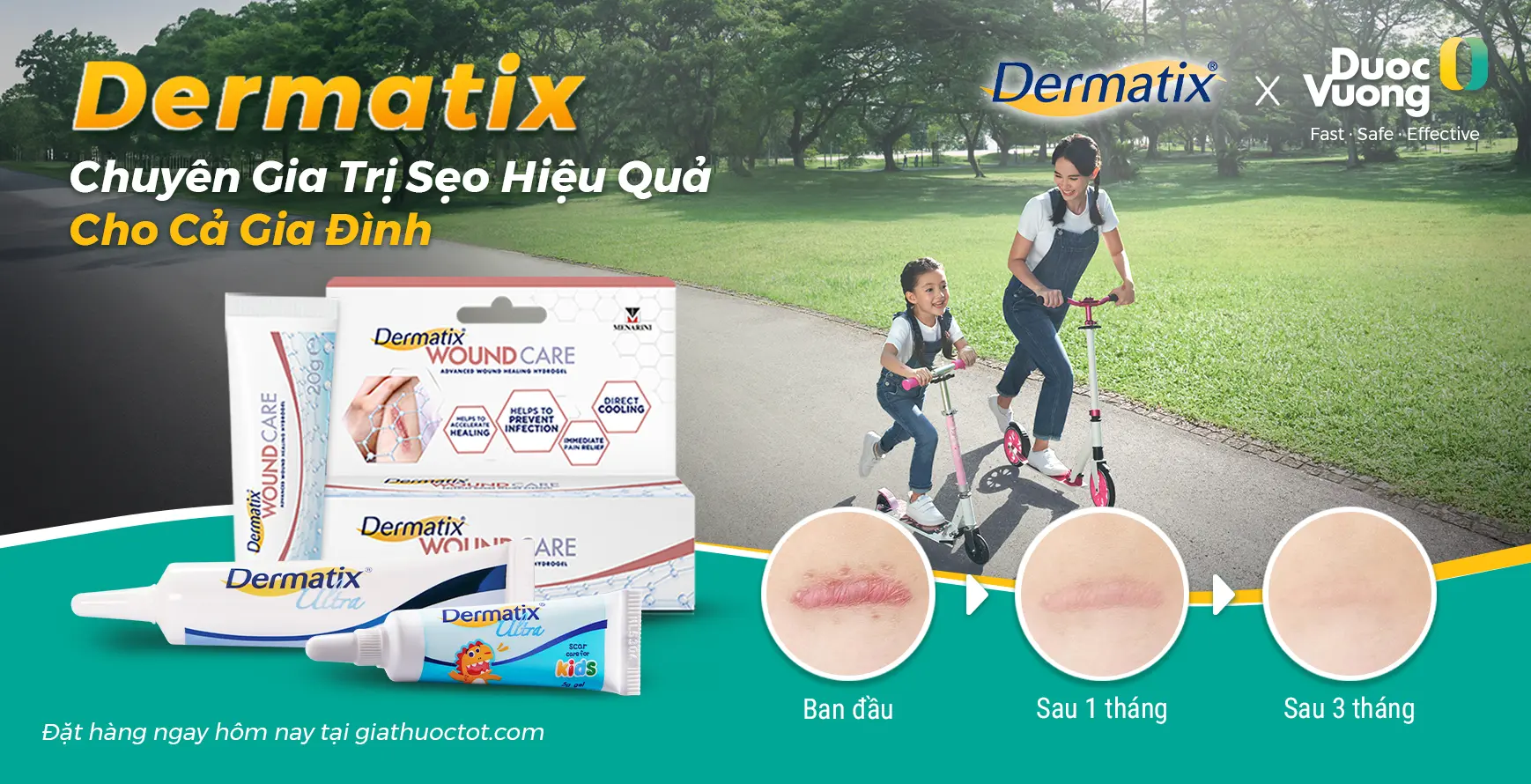 Dermatix - Chuyên Gia Cải Thiện Sẹo Hiệu Quả Cho Cả Gia Đình 