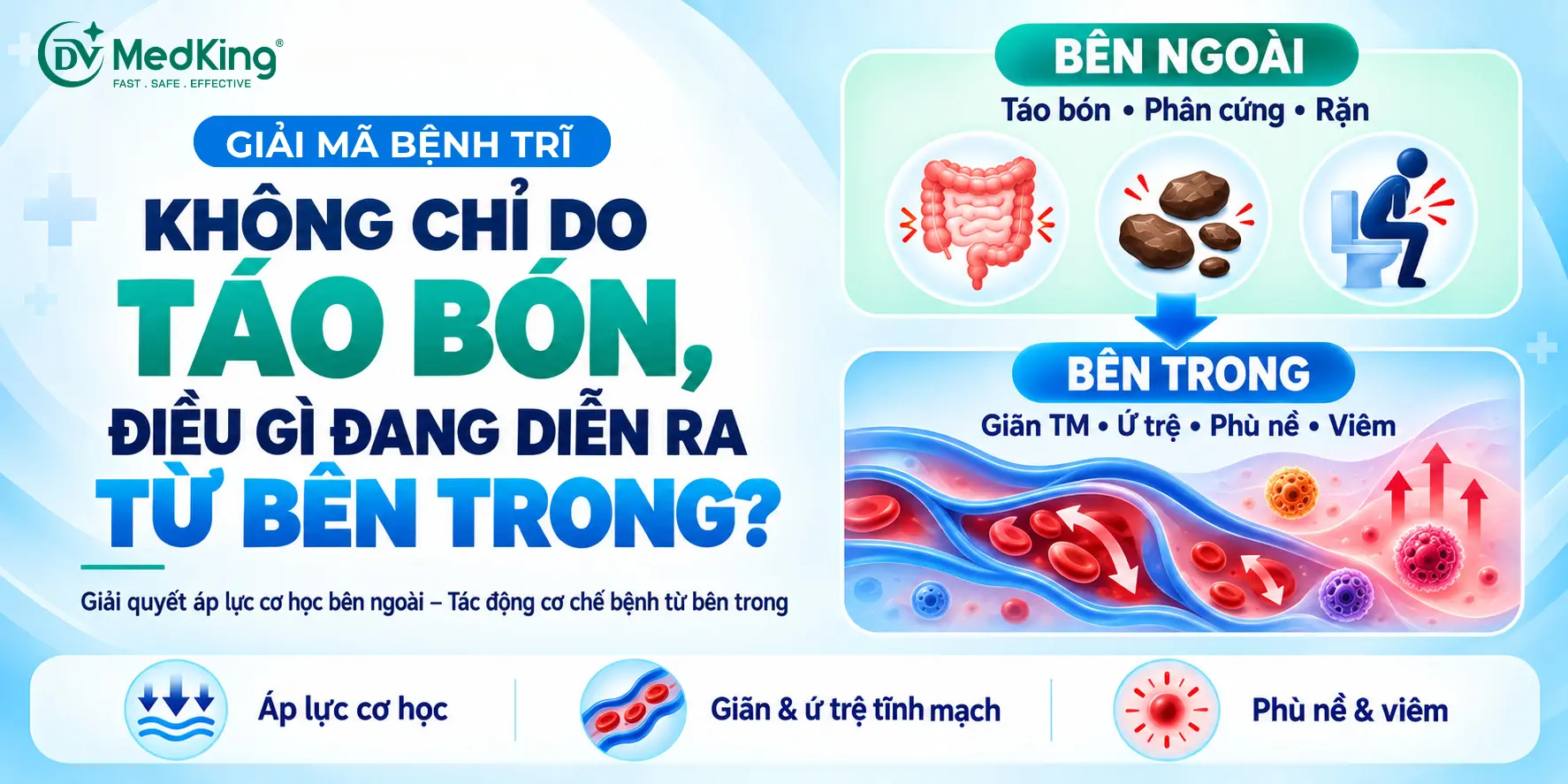Giải mã bệnh trĩ: Không chỉ do táo bón, điều gì đang diễn ra từ bên trong và giải pháp thuốc trĩ từ Pháp?