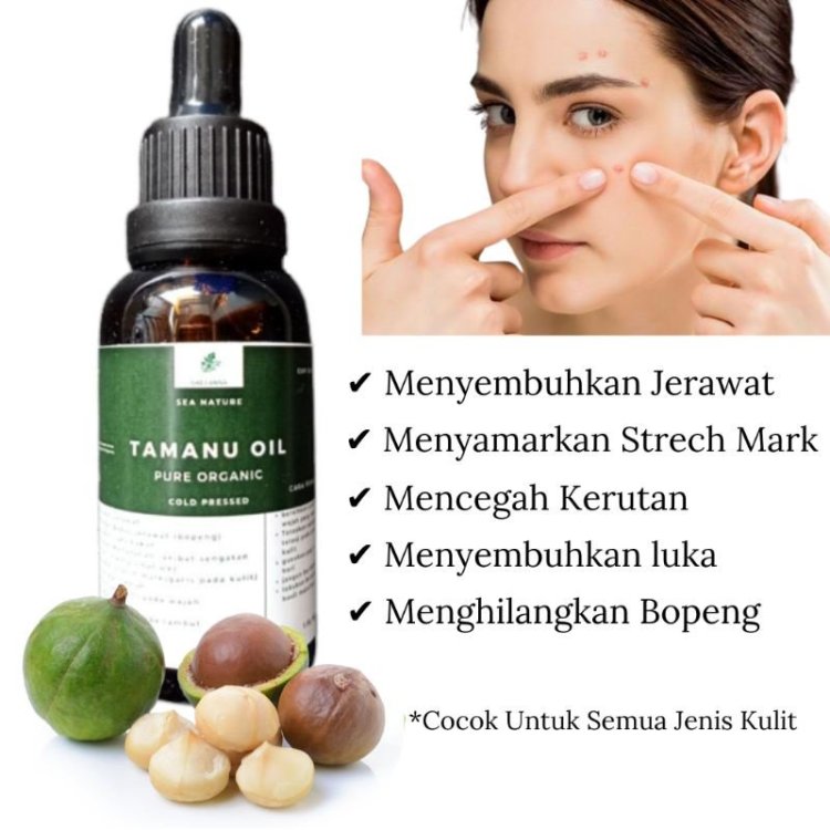 1754273164_TAMANUOILMURNI100PenghilangJerawatdanBopeng30ml.thumb.jpg.46107c8a31937608c6ba1ba0720f41ac.jpg