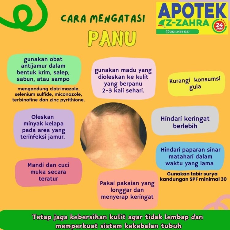 Tips Cara Mengatasi Panu Di Wajah Secara Alami Apotek AzZahra 24 Jam Terdekat.jpg