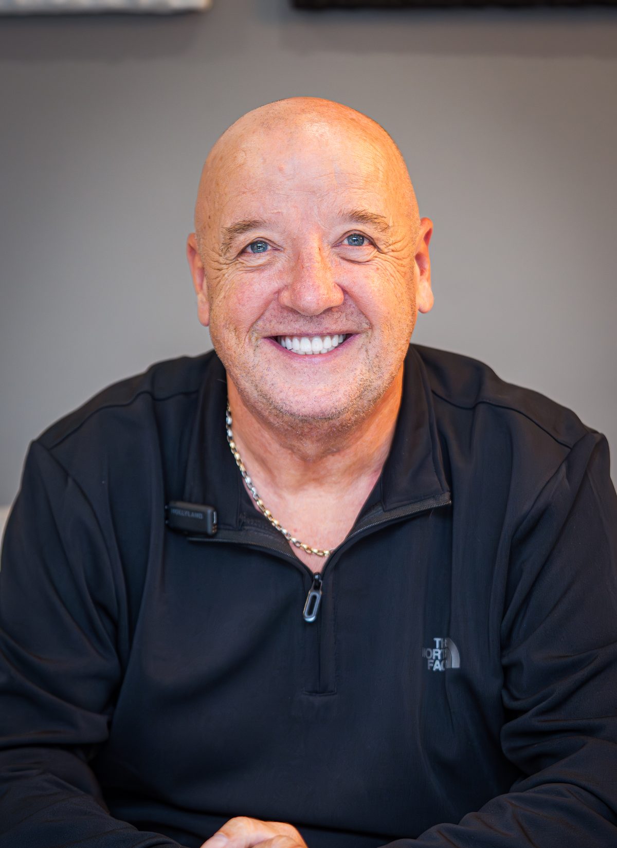 Steven — All-on-4 patient result