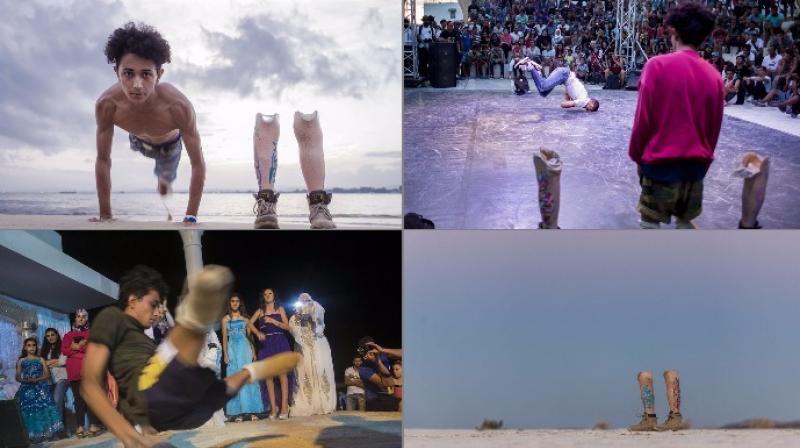 Photo series documents amputee breakdancers life