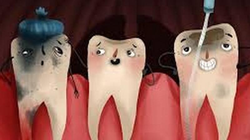 The effect of root canal work on patients oral health-related quality of life was compared to other kinds of dental work such as tooth extraction, restoration of teeth, repairs to the teeth or gum treatment, preventative treatment and cleaning. (Photo: ANI)