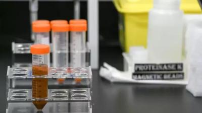 ITC starts clinical trials of nasal spray for COVID-19 prevention