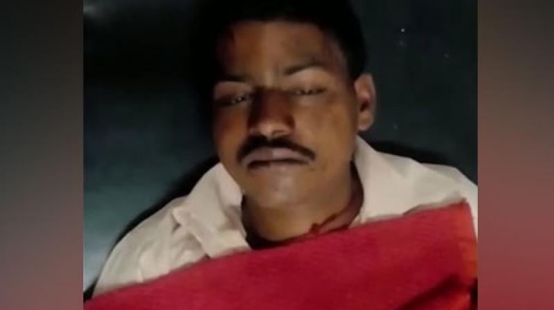 The victim working in Betul, a place situated within 178 kilometre from the capital of Bhopal, was identified as Manish and is currently under medical care. (Photo: Twitter | ANI)