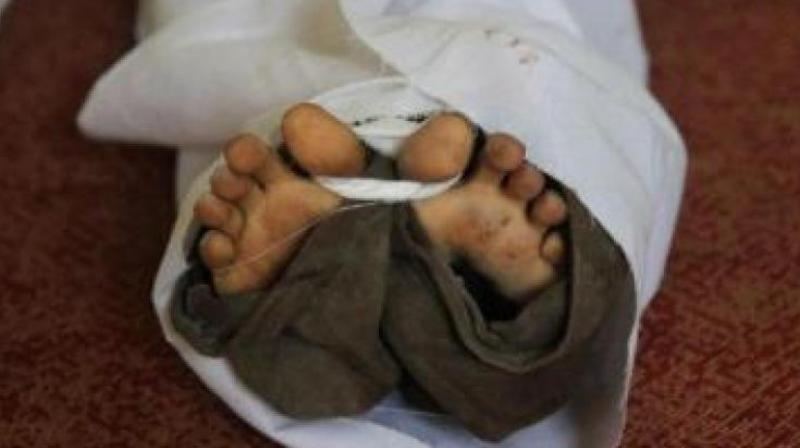 (Representational image)