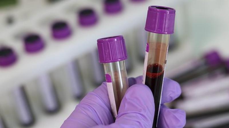 The new findings are now being incorporated into our computer models and will help us to identify the correct biomarkers even more precisely in the future. (Photo: Representational/Pixabay) The new findings are now being incorporated into our computer models and will help us to identify the correct biomarkers even more precisely in the future. (Photo: Representational/Pixabay)
