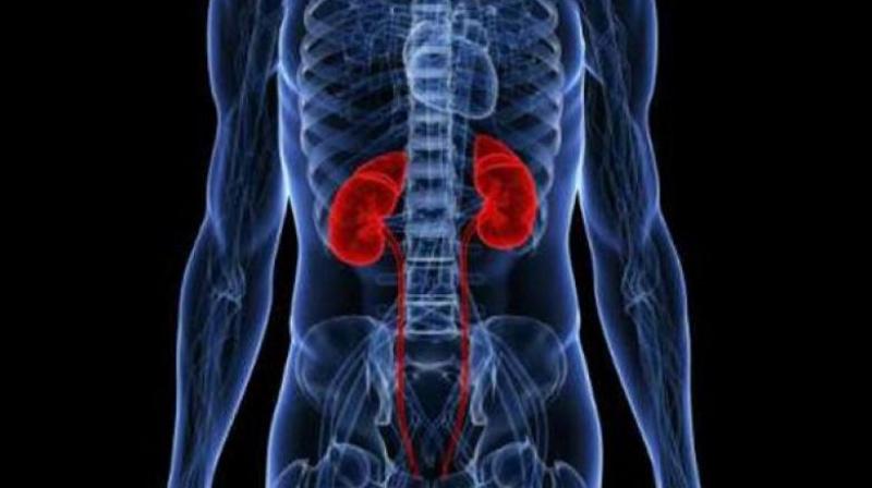 Diabetes, hypertension and other conditions cause CKD, which occurs when damaged kidneys cannot effectively filter waste and excess fluids from the body. Diabetes, hypertension and other conditions cause CKD, which occurs when damaged kidneys cannot effectively filter waste and excess fluids from the body.