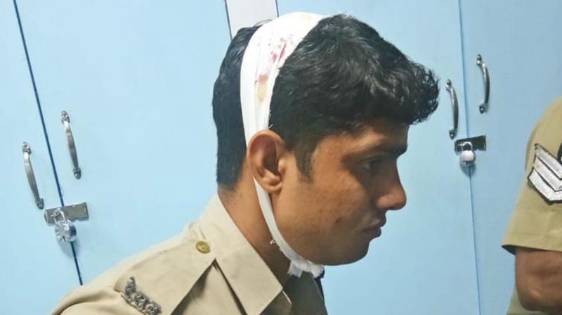 RPF constable Yogesh Kumar Meena who was kinifedby a cellphone snatcher, is under treatment. (Photo: DC) RPF constable Yogesh Kumar Meena who was kinifedby a cellphone snatcher, is under treatment. (Photo: DC)