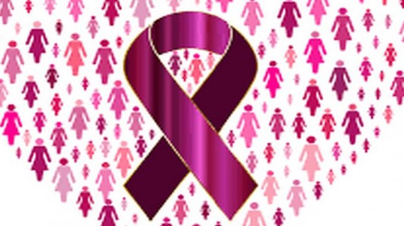 The findings do not indicate that anyone with elevated breast cancer risk should start taking aspirin, and people should speak to their doctors before they make changes to their medications. (Photo: ANI) The findings do not indicate that anyone with elevated breast cancer risk should start taking aspirin, and people should speak to their doctors before they make changes to their medications. (Photo: ANI)