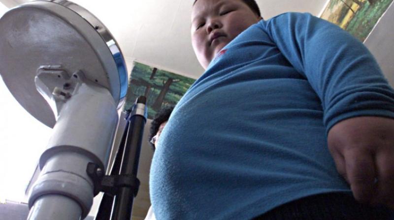 Excess calorie intake or insufficient physical activity or both, lead to overweight and obesity (Photo: AFP/Representational Image) Excess calorie intake or insufficient physical activity or both, lead to overweight and obesity (Photo: AFP/Representational Image)