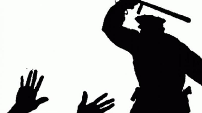A 28-year-old man who was detained by the Mangalhat police died under suspicious circumstances leading to tension in the area on Saturday. A 28-year-old man who was detained by the Mangalhat police died under suspicious circumstances leading to tension in the area on Saturday.