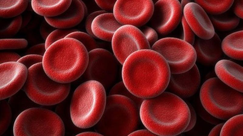 In the relatively inexpensive test, blood is drawn from an individual that may have suffered a concussion as the result of a sudden blow to the head. (Representational Image) In the relatively inexpensive test, blood is drawn from an individual that may have suffered a concussion as the result of a sudden blow to the head. (Representational Image)