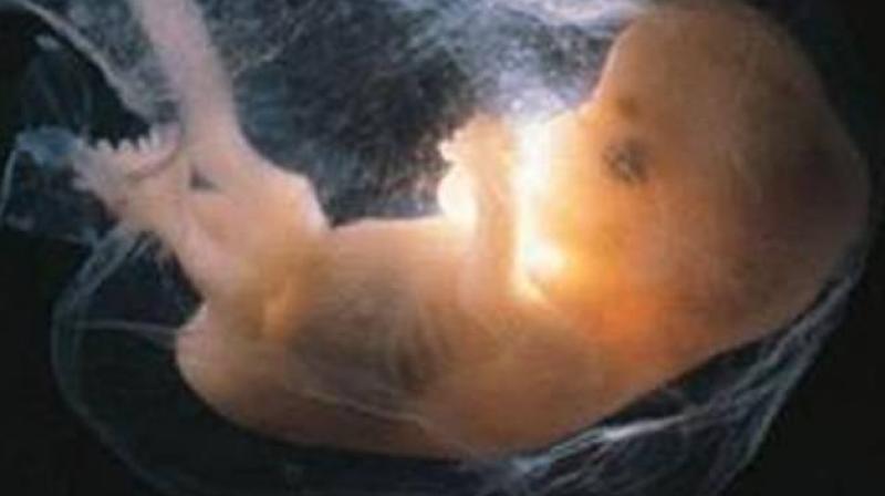 Three foetuses were seen floating on Monday in a drainage channel in Tiruchirappalli, Tamil Nadu. (Photo: PTI/Representational) Three foetuses were seen floating on Monday in a drainage channel in Tiruchirappalli, Tamil Nadu. (Photo: PTI/Representational)