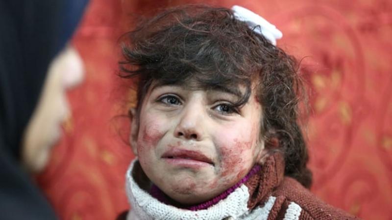 After the council vote Saturday, Syrian warplanes backed by Russian air power launched new raids on a town in Eastern Ghouta, the Syrian Observatory for Human Rights said. (Photo: AFP) After the council vote Saturday, Syrian warplanes backed by Russian air power launched new raids on a town in Eastern Ghouta, the Syrian Observatory for Human Rights said. (Photo: AFP)
