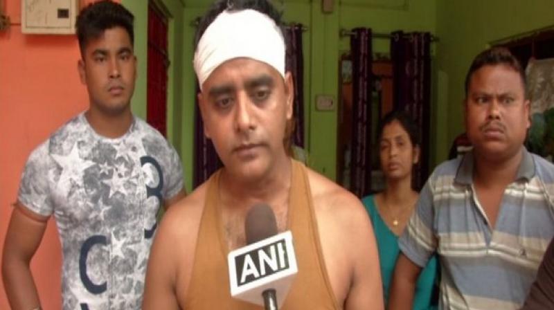 Uttam Mondal, New Colony booth unit president of BJP, and his brother Gautam Mondal were attacked at their shop in the city’s Matigara area. (Photo: ANI) Uttam Mondal, New Colony booth unit president of BJP, and his brother Gautam Mondal were attacked at their shop in the city’s Matigara area. (Photo: ANI)
