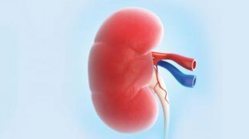 In India, donors have to be related to the patient they are donating the kidney to in order to stop poor people from selling their kidneys for money and endangering their own health. (Representational image) In India, donors have to be related to the patient they are donating the kidney to in order to stop poor people from selling their kidneys for money and endangering their own health. (Representational image)