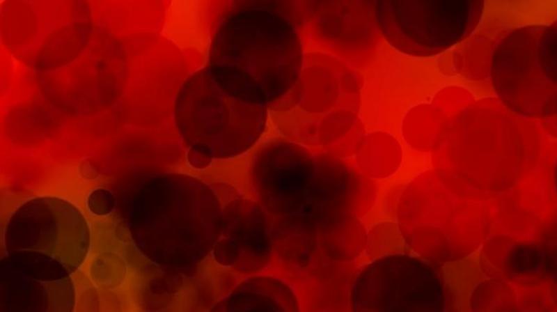 Researcher find three-dimensional cultured spheroids provide a much more predictive way to test many different medications to treat cancer. (Photo: Pexels) Researcher find three-dimensional cultured spheroids provide a much more predictive way to test many different medications to treat cancer. (Photo: Pexels)