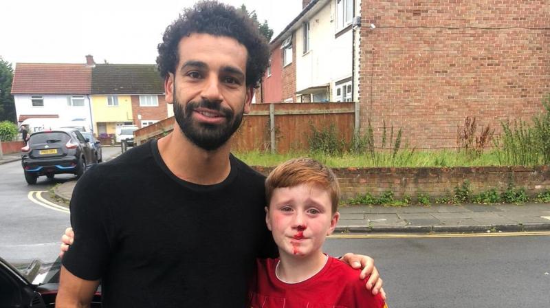 Louis Fowler, 11, crashed into a lamppost and fell to the ground with blood coming out of his nose after he and his younger brother Isaac ran beside Salah’s car on Saturday while waving at the Liverpool player. Photo: Twitter/Joe Cooper) Louis Fowler, 11, crashed into a lamppost and fell to the ground with blood coming out of his nose after he and his younger brother Isaac ran beside Salah’s car on Saturday while waving at the Liverpool player. Photo: Twitter/Joe Cooper)