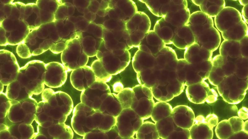 Former model eaten alive by scabies. (Photo: Pixabay) Former model eaten alive by scabies. (Photo: Pixabay)