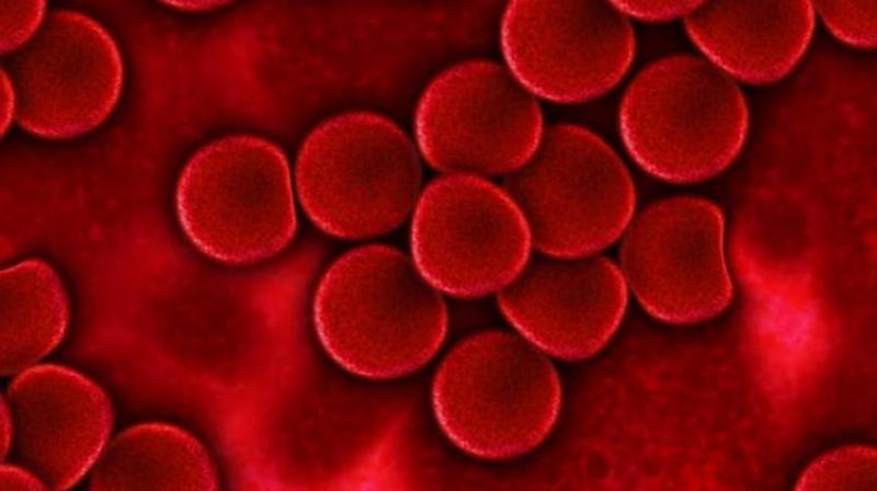 The study appears in the journal Cell Chemical Biology. (Photo: Pixabay) The study appears in the journal Cell Chemical Biology. (Photo: Pixabay)