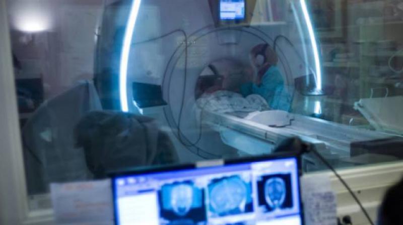 Having MRI findings of MS without any symptoms of the disease has been termed radiologically isolated syndrome (RIS) (Photo: AFP) Having MRI findings of MS without any symptoms of the disease has been termed radiologically isolated syndrome (RIS) (Photo: AFP)