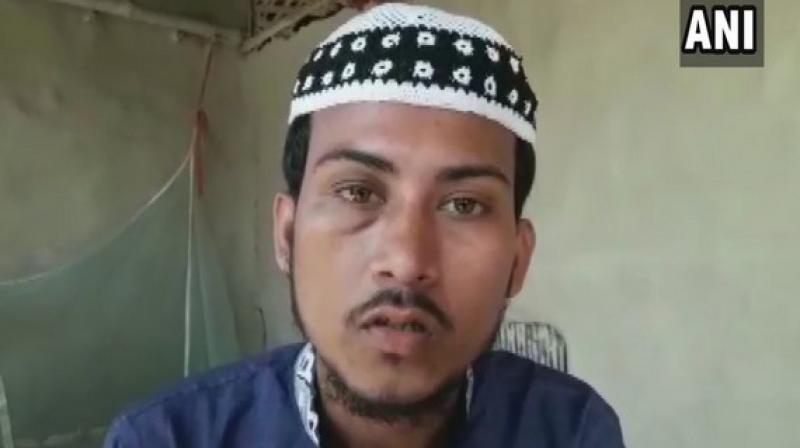 Halder said the local people there rescued him and took him to a hospital for treatment following which he lodged a complaint at the Government Railway Police (GRP) station in Baliganj. (Photo: ANI) Halder said the local people there rescued him and took him to a hospital for treatment following which he lodged a complaint at the Government Railway Police (GRP) station in Baliganj. (Photo: ANI)