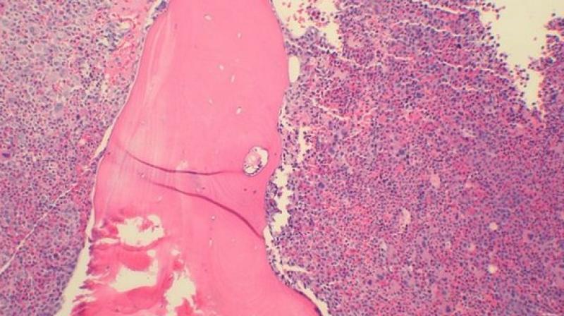 The researchers also discovered that abnormal protein does not act alone. (Photo: ANI) The researchers also discovered that abnormal protein does not act alone. (Photo: ANI)