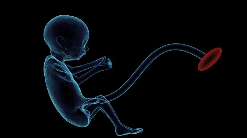 Mother to donate terminally ill unborn child's organs to babies that will need it. (Photo: Pixabay) Mother to donate terminally ill unborn child's organs to babies that will need it. (Photo: Pixabay)
