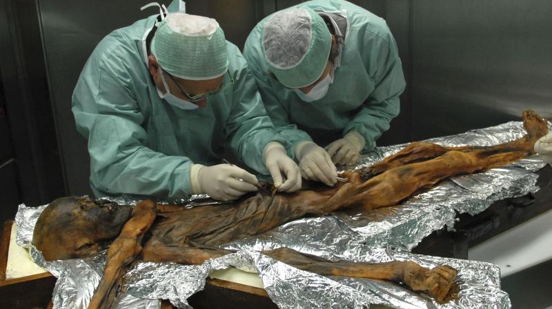 In this November 2010 photo provided by the South Tyrol Museum of Archaeology, researchers examine the body of a frozen hunter known as Oetzi the Iceman to sample his stomach contents in Bolzano, Italy. (Photo: AP) In this November 2010 photo provided by the South Tyrol Museum of Archaeology, researchers examine the body of a frozen hunter known as Oetzi the Iceman to sample his stomach contents in Bolzano, Italy. (Photo: AP)