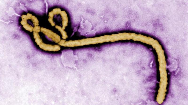 New Ebola virus found in Sierra Leone. (Photo: AP) New Ebola virus found in Sierra Leone. (Photo: AP)