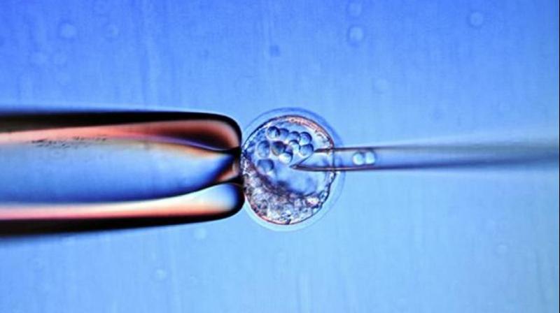 Researchers hope that by transplanting human stem cells onto newly-formed chicken embryos they can find out more about how cells transform into foetuses. (Photo: AFP) Researchers hope that by transplanting human stem cells onto newly-formed chicken embryos they can find out more about how cells transform into foetuses. (Photo: AFP)