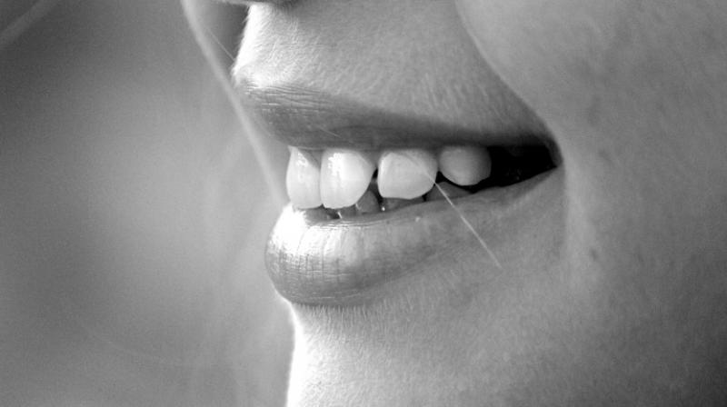 Aspirin could reverse the effects of tooth decay, new study finds. (Photo: Pixabay) Aspirin could reverse the effects of tooth decay, new study finds. (Photo: Pixabay)