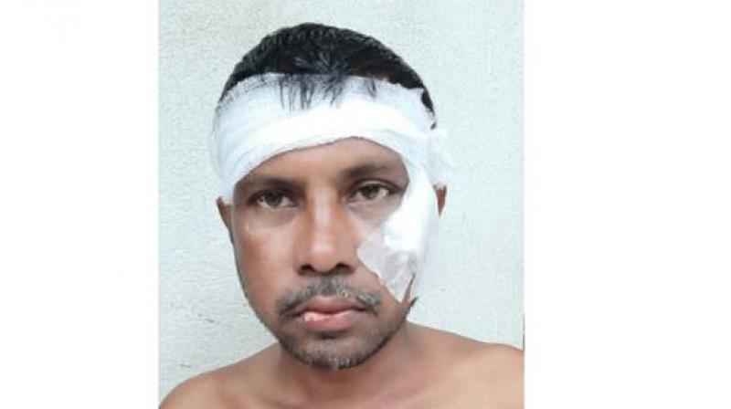 A case has been registered in Harwa Police Station. However, no arrest has been made so far. (Photo: ANI) A case has been registered in Harwa Police Station. However, no arrest has been made so far. (Photo: ANI)