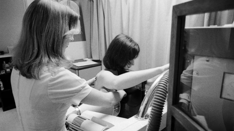 Breast density compares the amount of fat to the amount of other types of tissue in a mammogram image. (Photo: AP) Breast density compares the amount of fat to the amount of other types of tissue in a mammogram image. (Photo: AP)