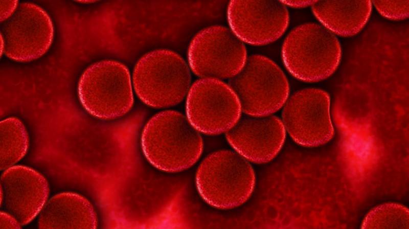 Gland cancer risk high for adults with congenital heart defects. (Photo: Pixabay) Gland cancer risk high for adults with congenital heart defects. (Photo: Pixabay)