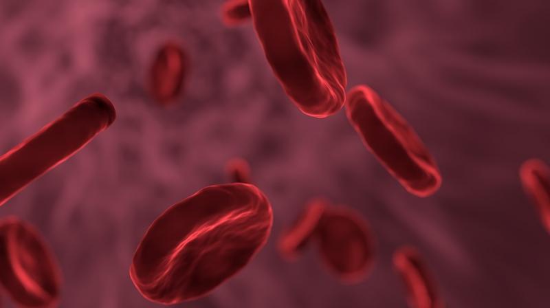 Facts about sickle cell disease. (Photo: Pixabay) Facts about sickle cell disease. (Photo: Pixabay)