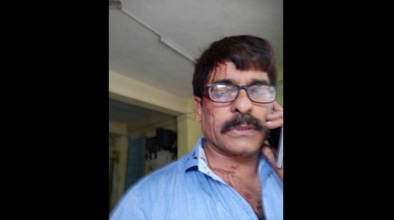 Sudhir Shukla, who works for a Hindi news channel, sustained injuries in the attack that took place between Mira Road and Andheri railway stations. (Photo; Facebook) Sudhir Shukla, who works for a Hindi news channel, sustained injuries in the attack that took place between Mira Road and Andheri railway stations. (Photo; Facebook)
