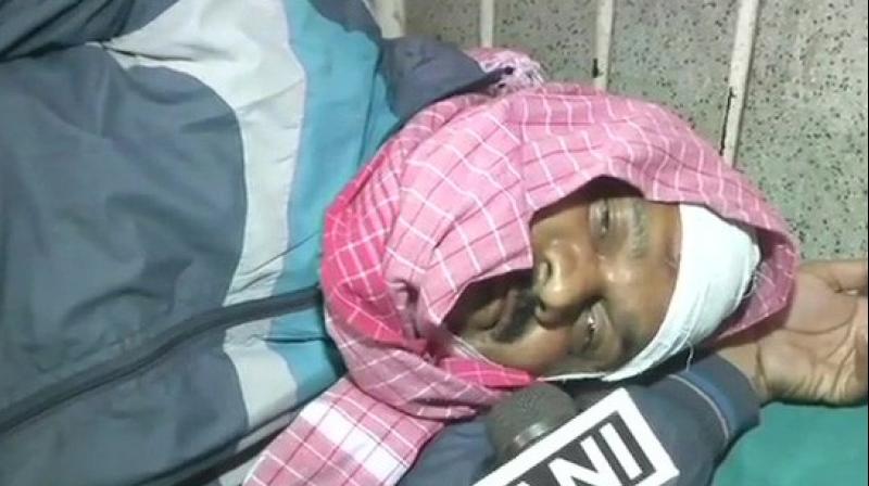 After the arrest, Manoj Baitha was shifted to Patna Medical College & Hospital from Sri Krishna Medical College & Hospital for treatment of the injuries he suffered during the accident. (Photo: ANI) After the arrest, Manoj Baitha was shifted to Patna Medical College & Hospital from Sri Krishna Medical College & Hospital for treatment of the injuries he suffered during the accident. (Photo: ANI)