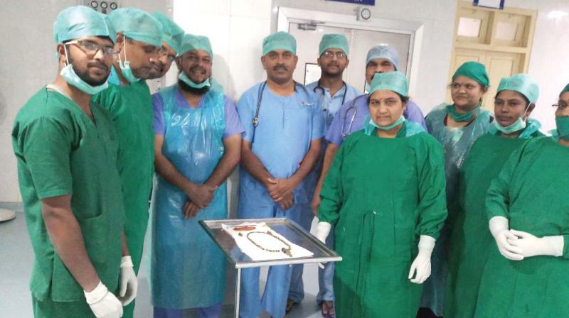 From left, the 99 gallstones removed from woman’s body in Tumakuru. A team of surgeons at District Hospital Tumakuru who conducted the surgery. (Photo:DC) From left, the 99 gallstones removed from woman’s body in Tumakuru. A team of surgeons at District Hospital Tumakuru who conducted the surgery. (Photo:DC)