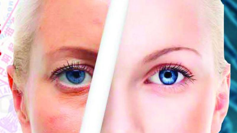 Experts state that at the clinical level, biological age is not used as there is too much of resistance in people who are not able to understand what it means. Experts state that at the clinical level, biological age is not used as there is too much of resistance in people who are not able to understand what it means.