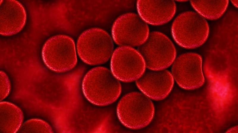 Scientists discover protein that causes cancer growth. (Photo: Pixabay) Scientists discover protein that causes cancer growth. (Photo: Pixabay)