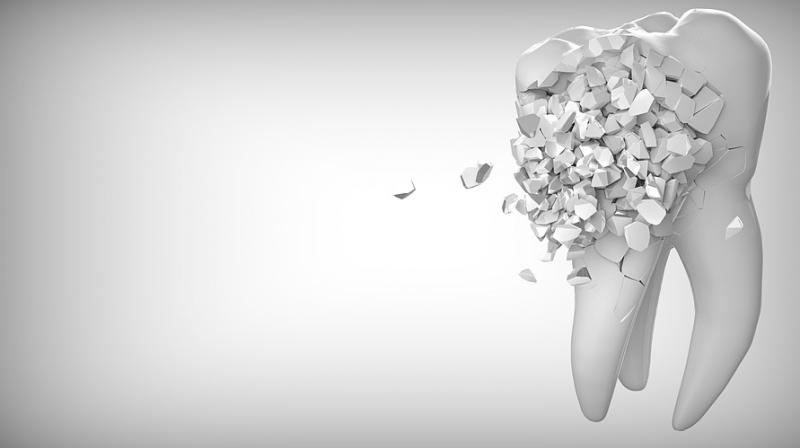 Dangers of delaying your child's first trip to the dentist. (Photo: Pixabay) Dangers of delaying your child's first trip to the dentist. (Photo: Pixabay)